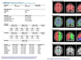 volBrain: análisis on line y gratuito de imágenes de resonancia magnética del cerebro