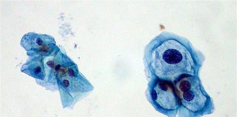 Solo la mitad de las CCAA han cumplido la cobertura de vacunación frente al papilomavirus