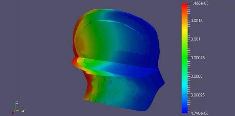 Radioterapia personalizada con un nuevo método desarrollado por investigadores de Valencia y Castellón