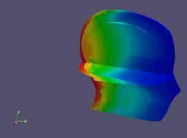 Radioterapia personalizada con un nuevo método desarrollado por investigadores de Valencia y Castellón