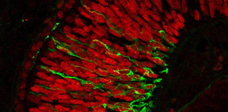 Identifican una nueva posible causa genética de microftalmia