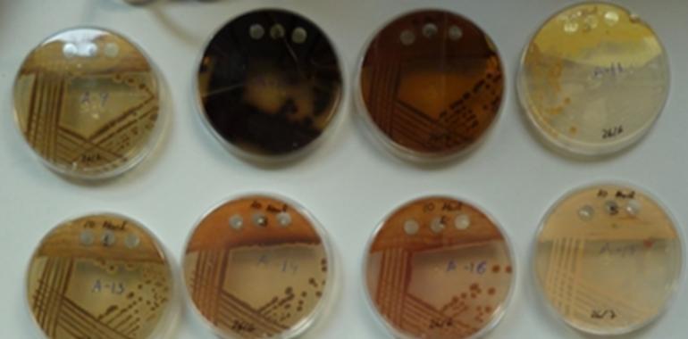 Investigadores de la Universidad de Oviedo hallan bacterias con potencial terapéutico en el agua de lluvia