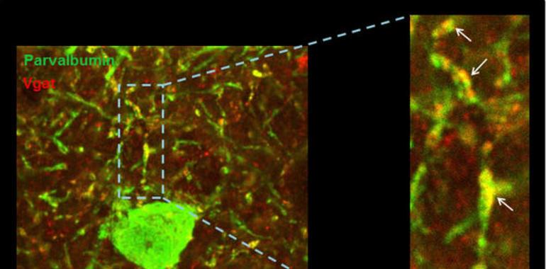 El ritmo de las ondas en la corteza cerebral, clave para el síndrome de Down