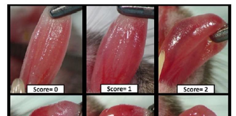 Matemáticos de #Uniovi participan en el descubrimiento de una molécula contra cáncer de cabeza y cuello