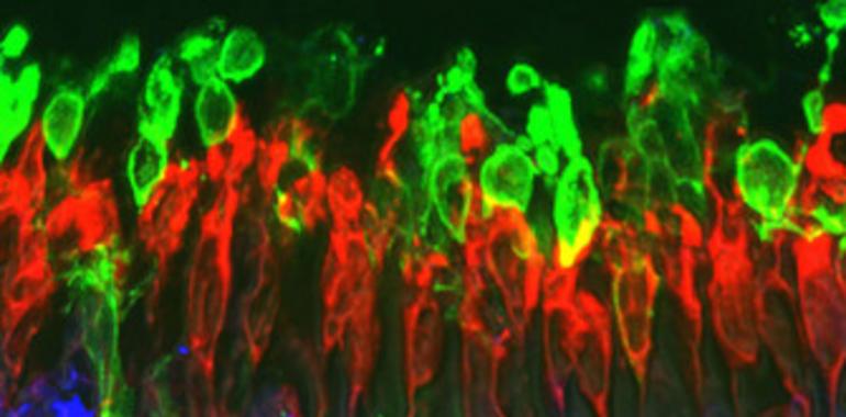 Prótesis moleculares para restaurar la vista en degeneración de retina