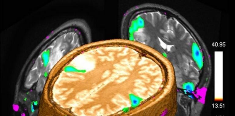 Una cuarta Resonancia permitirá al HUCA hacer 5.000 pruebas más al año