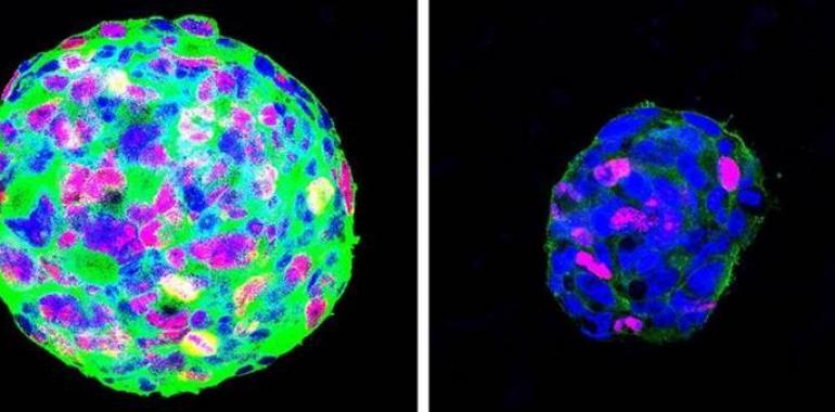 Identificada una proteína clave en la progresión de los tumores por investigadores del CSIC