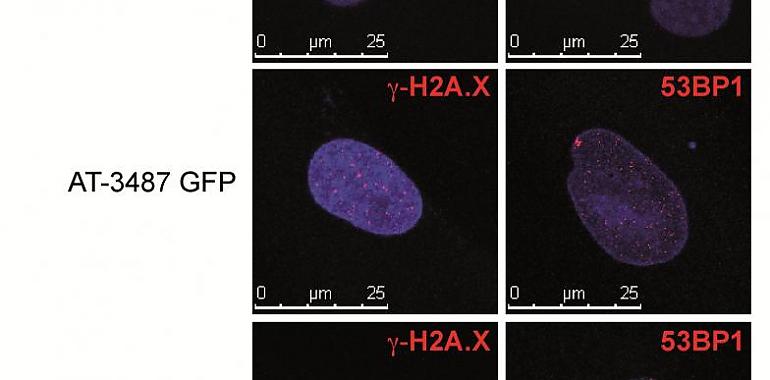 El CSIC descubre una nueva diana terapéutica para la ataxia telangiectasia