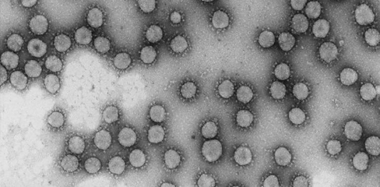 Dos proyectos del CSIC obtienen financiación europea urgente para investigar el coronavirus de Wuhan