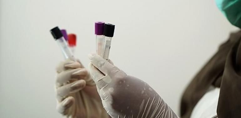 Descienden a 67 los nuevos positivos por coronavirus en Asturias