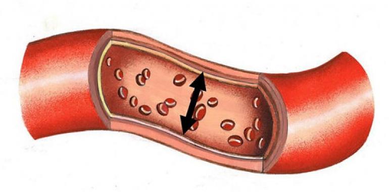 ¿Vigilas suficientemente tu tensión arterial?