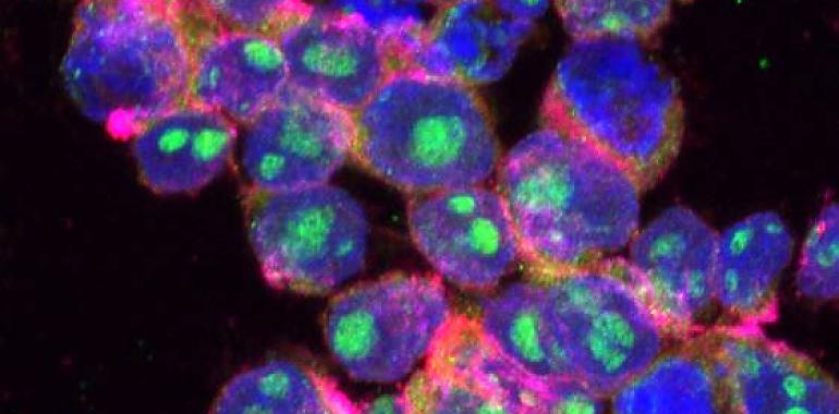 Desarrollo de nanoterapias contra el cáncer mediante nanocápsulas controladas externamente