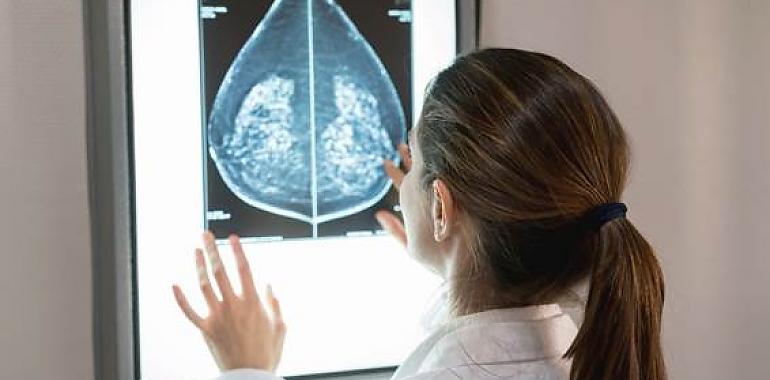 Nuevo predictor de riesgo para cáncer de mama