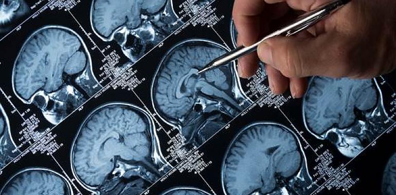 Un equipo del CSIC determina el origen de las corrientes eléctricas en el cerebro de pacientes epilépticos