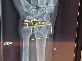 El Hospital Álvarez Buylla de Mieres revoluciona el diagnóstico con inteligencia artificial para urgencias