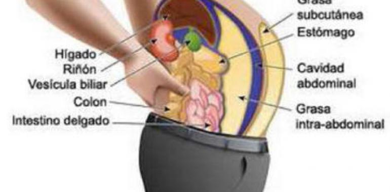 Marcapasos gástricos para corregir la obesidad mórbida