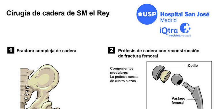 La operación de SM Don Juan Carlos incluyó una prótesis