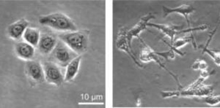 Cortactin: oncoproteína clave para entender la infección por Helicobacter pylori